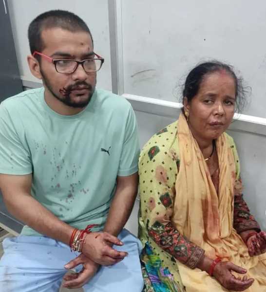 लालकुआँ में लोमड़ी ने किया माँ-बेटे पर हमला,लेकिन नहीं लग पाया रेबीज का इंजेक्शन..और फिर ??