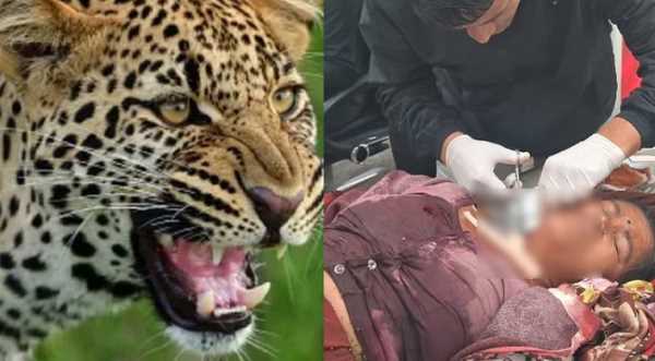  चमोली में शौच के लिए जा रही महिला पर गुलदार ने किया हमला, अस्पताल में भर्ती