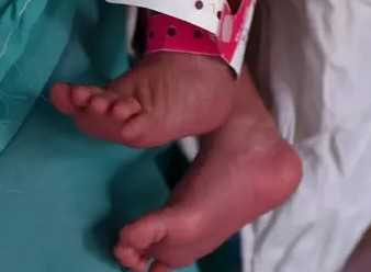 होटल की खिड़की से गिरा मासूम! 3 साल के बच्चे की हालत गंभीर